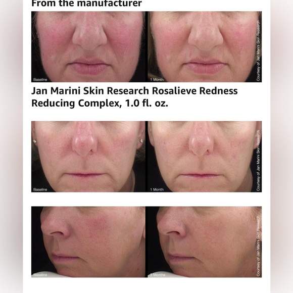 NIB Jan Marini rosalieve redness reducing complex - Picture 5 of 5